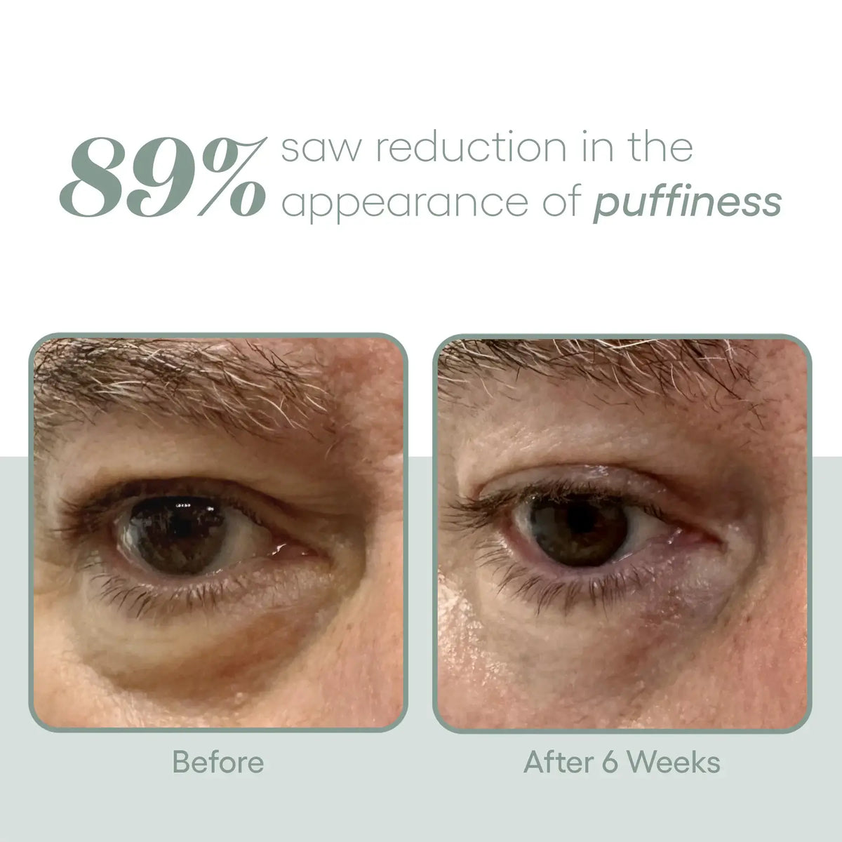 Plated Eye Serum | Sage Aesthetic Wellness
