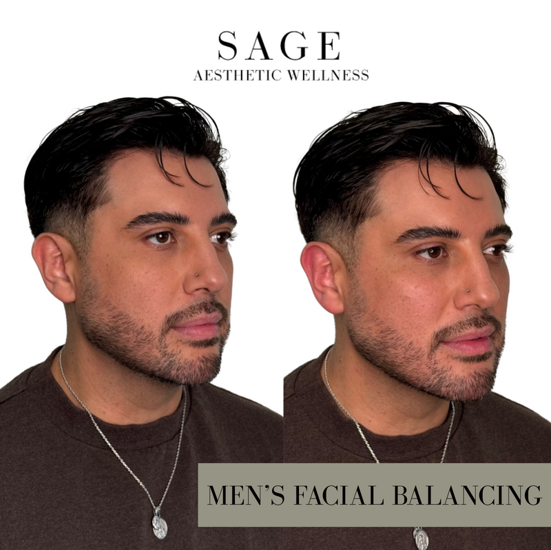 Before and after results of men’s facial balancing treatment at Sage Aesthetic Wellness Scottsdale.