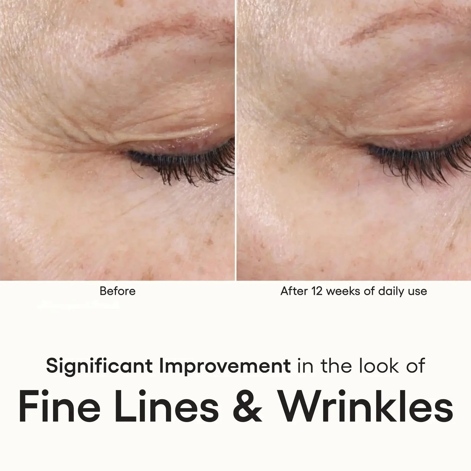 ( plated ) INTENSE Serum – Advanced Exosome Skin Renewal Serum
