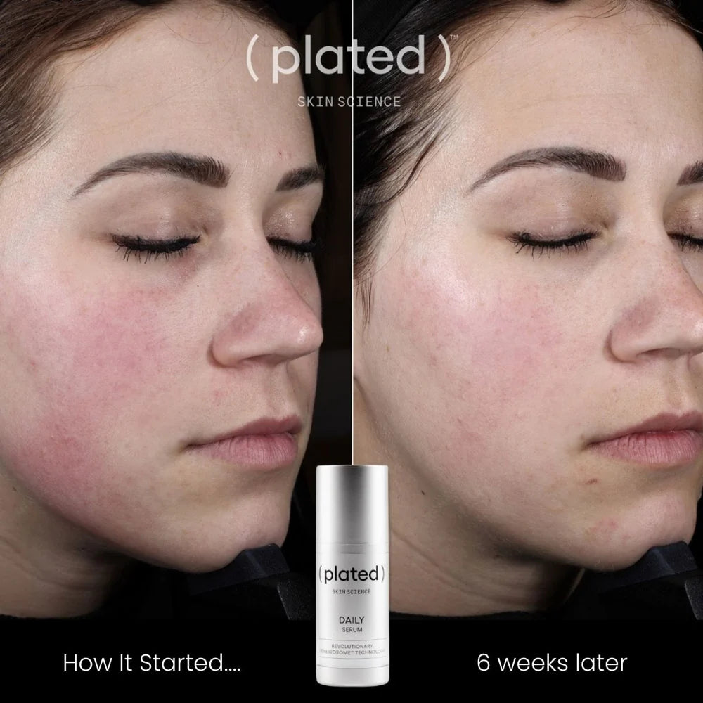 ( plated ) DAILY Serum – Exosome Serum for Hydration &amp; Skin Renewal