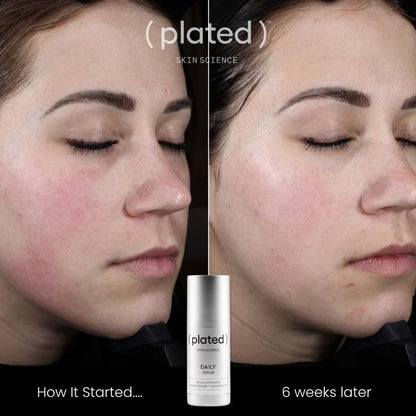 ( plated ) DAILY Serum – Exosome Serum for Hydration &amp; Skin Renewal