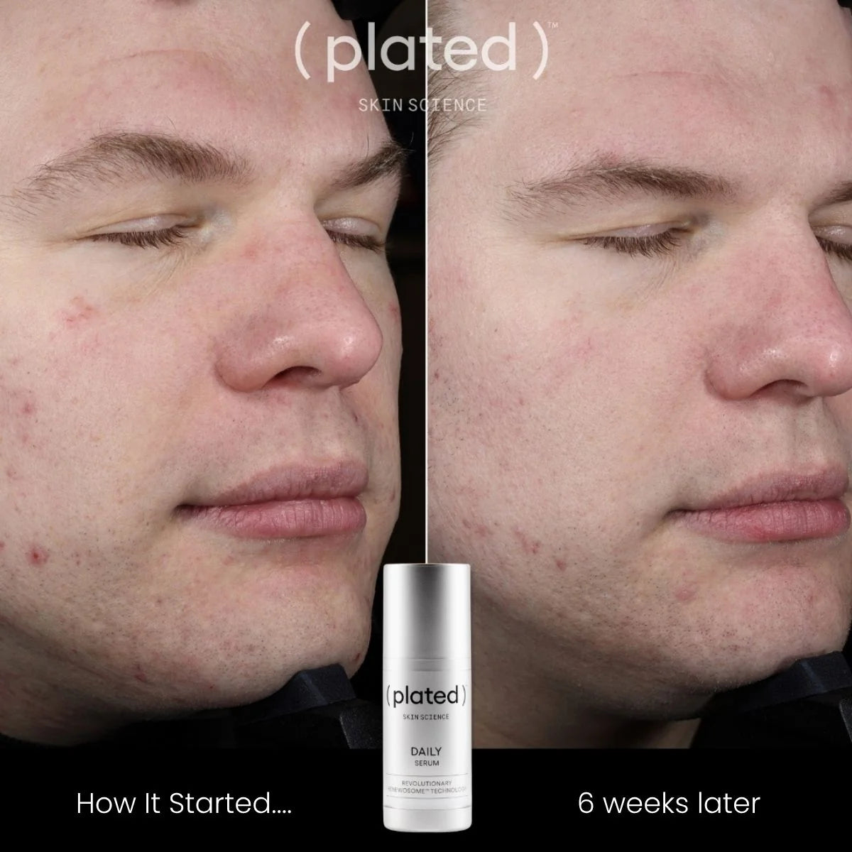 ( plated ) DAILY Serum – Exosome Serum for Hydration &amp; Skin Renewal