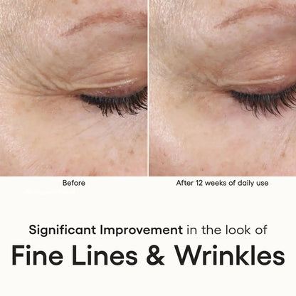 ( plated ) INTENSE Serum – Advanced Exosome Skin Renewal Serum